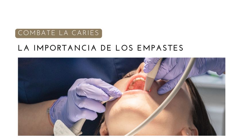 La importancia de los empastes dentales para combatir la caries