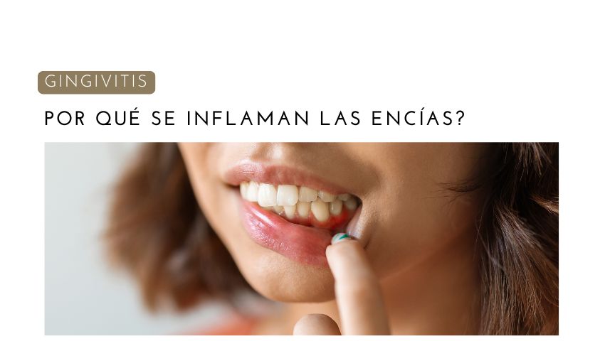 ¿Por Qué se Inflaman las Encías?