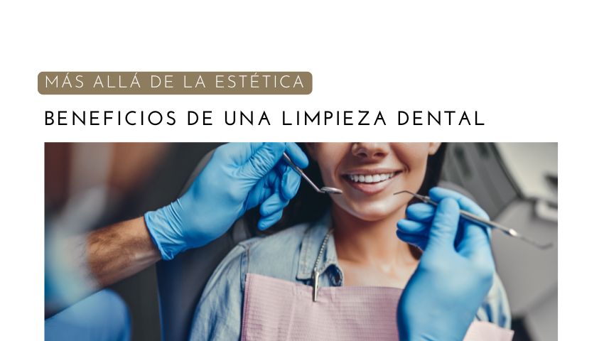 Beneficios de una Limpieza Dental Profesional