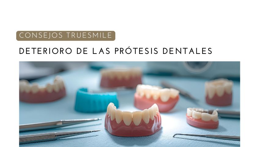 Cómo Actuar si se Desgasta una Prótesis Dental