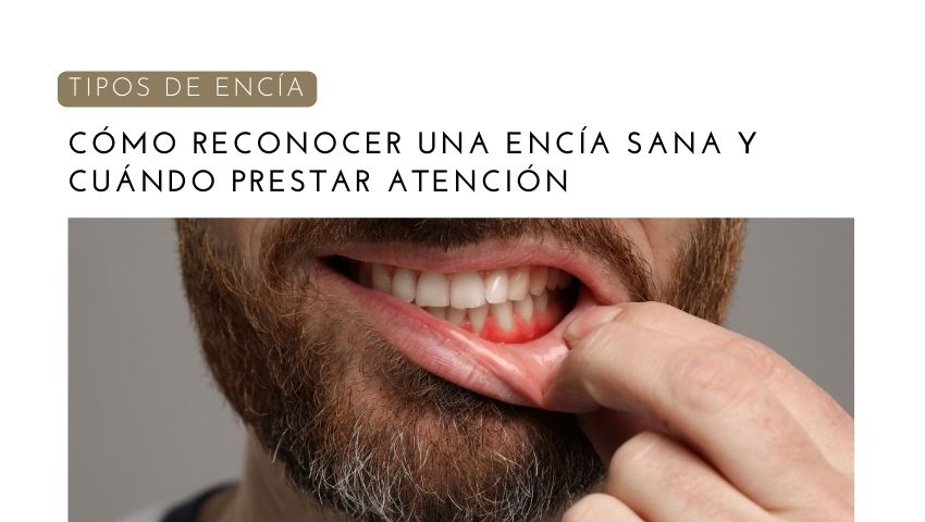 Tipos de Encía | Cómo reconocer una encía sana y cuándo prestar atención